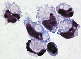 GIST image